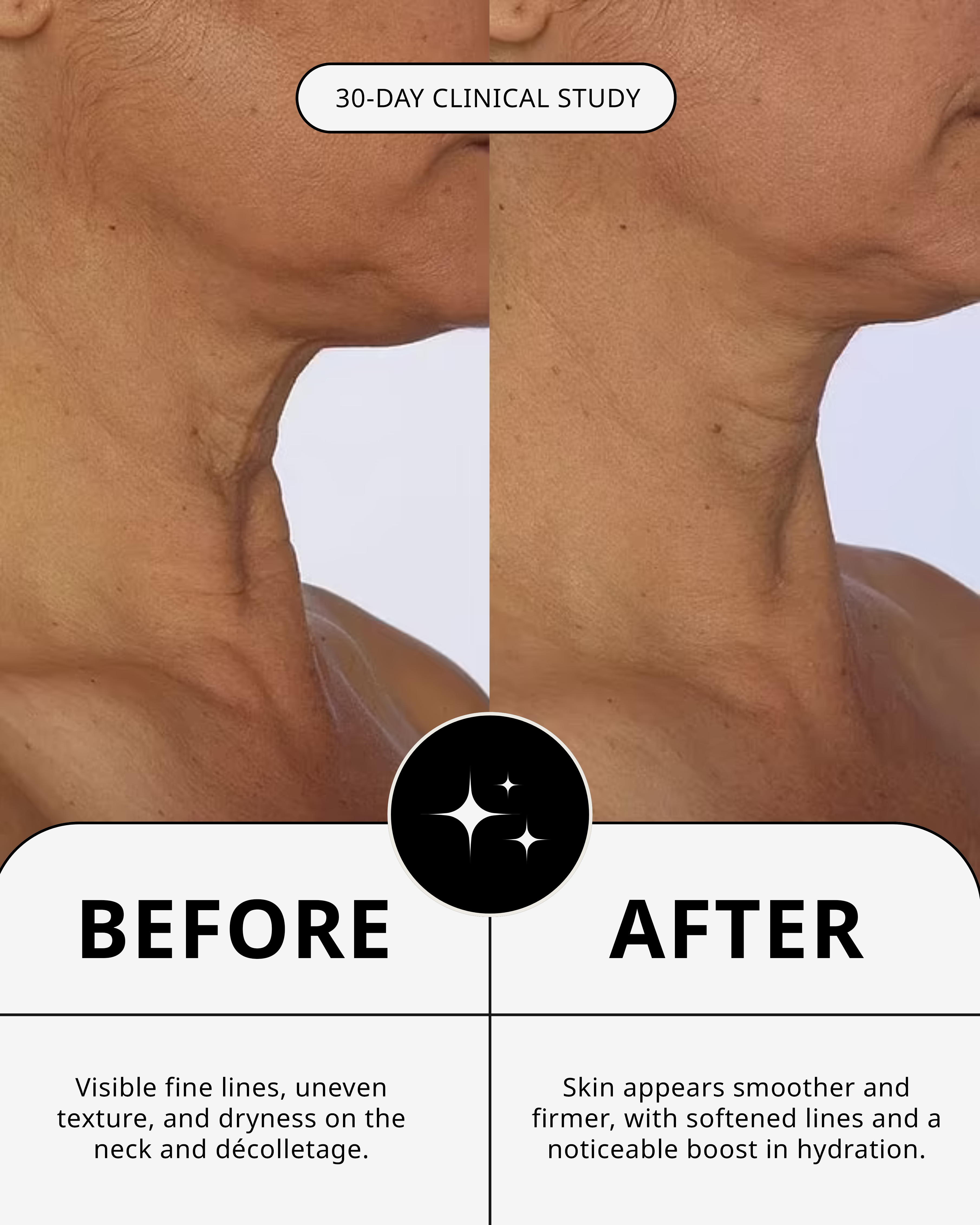 THE NECK TREATMENT