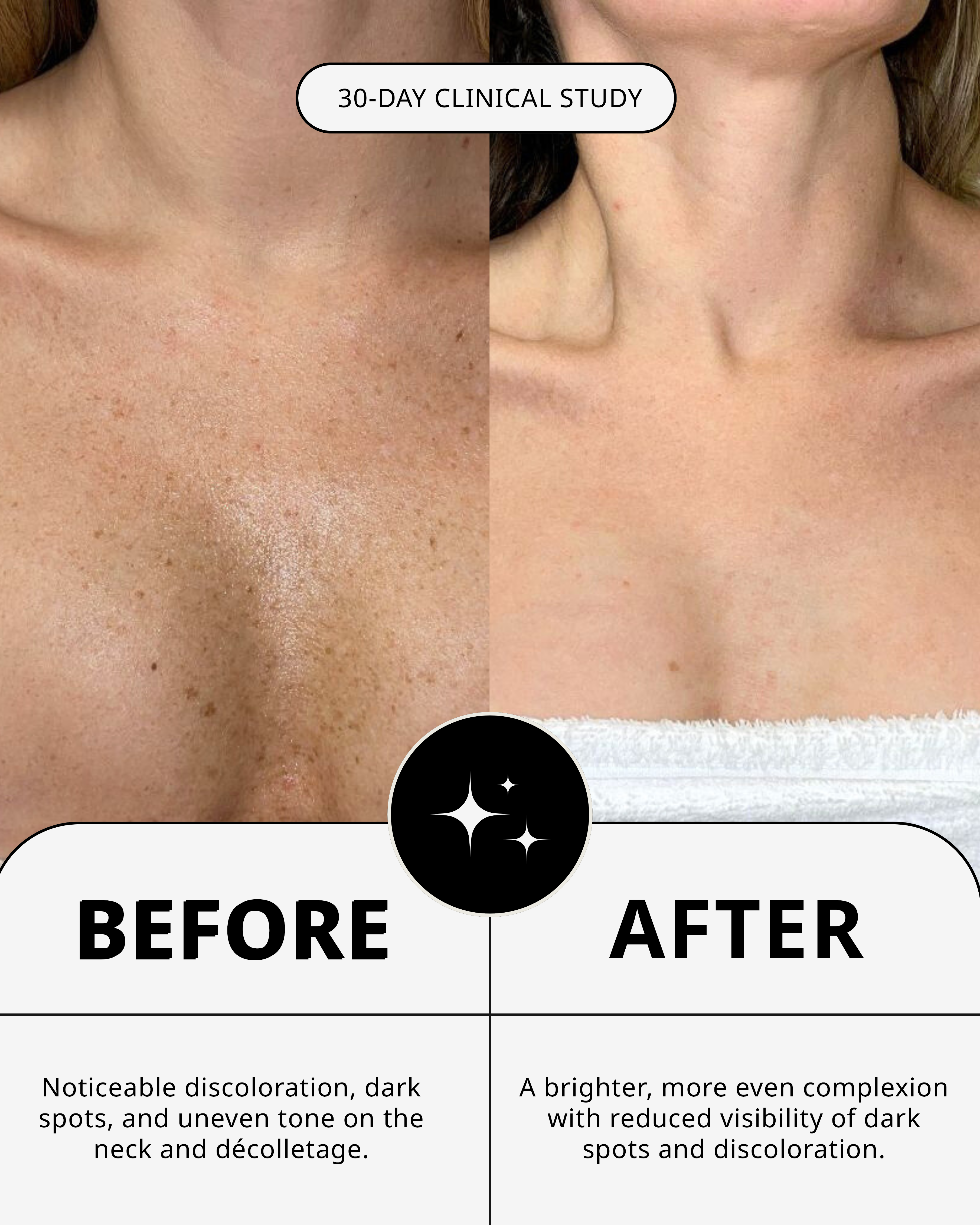 THE NECK TREATMENT