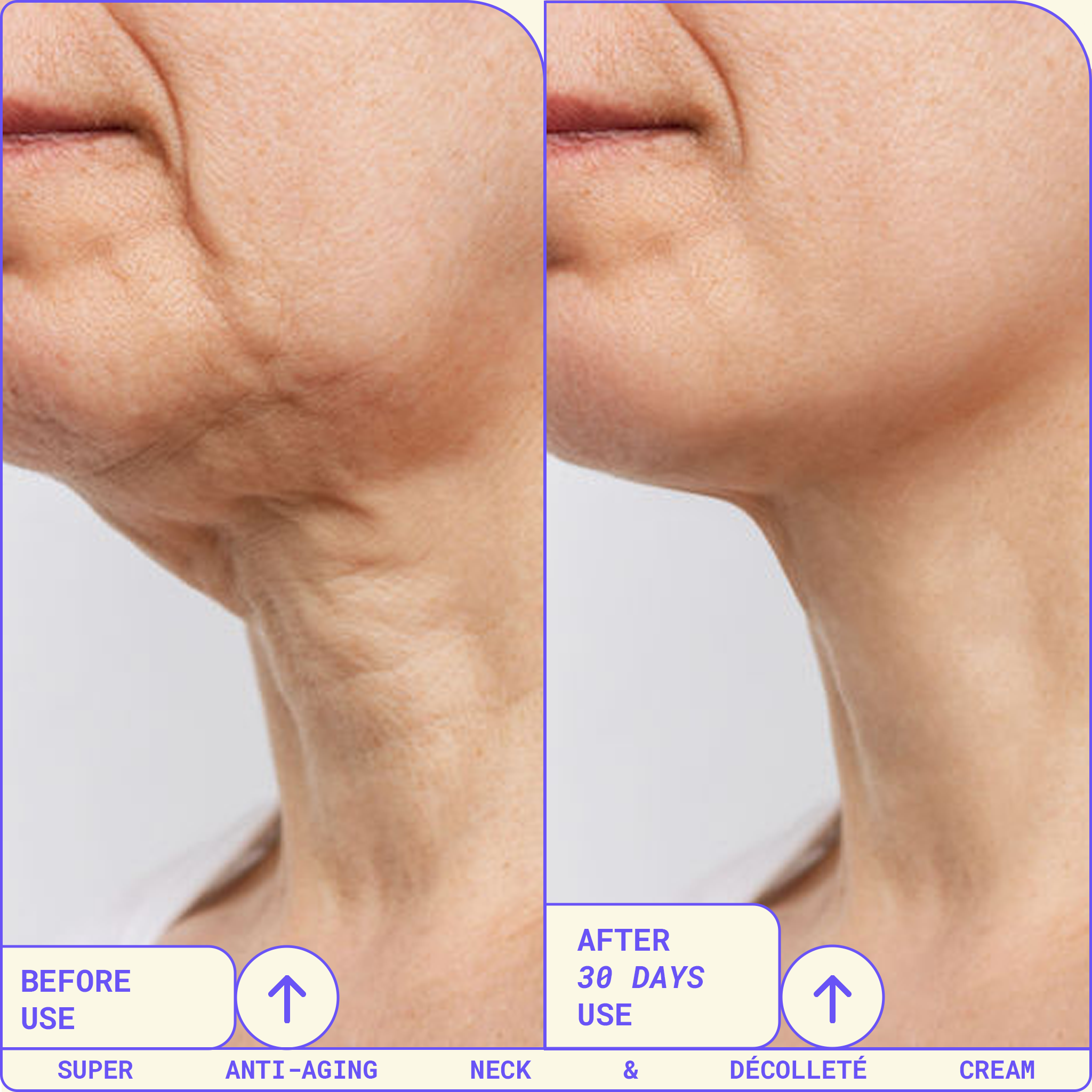 Neckbefore_after_d9ca6445-0b6a-464f-a66f-738be8889b02.png