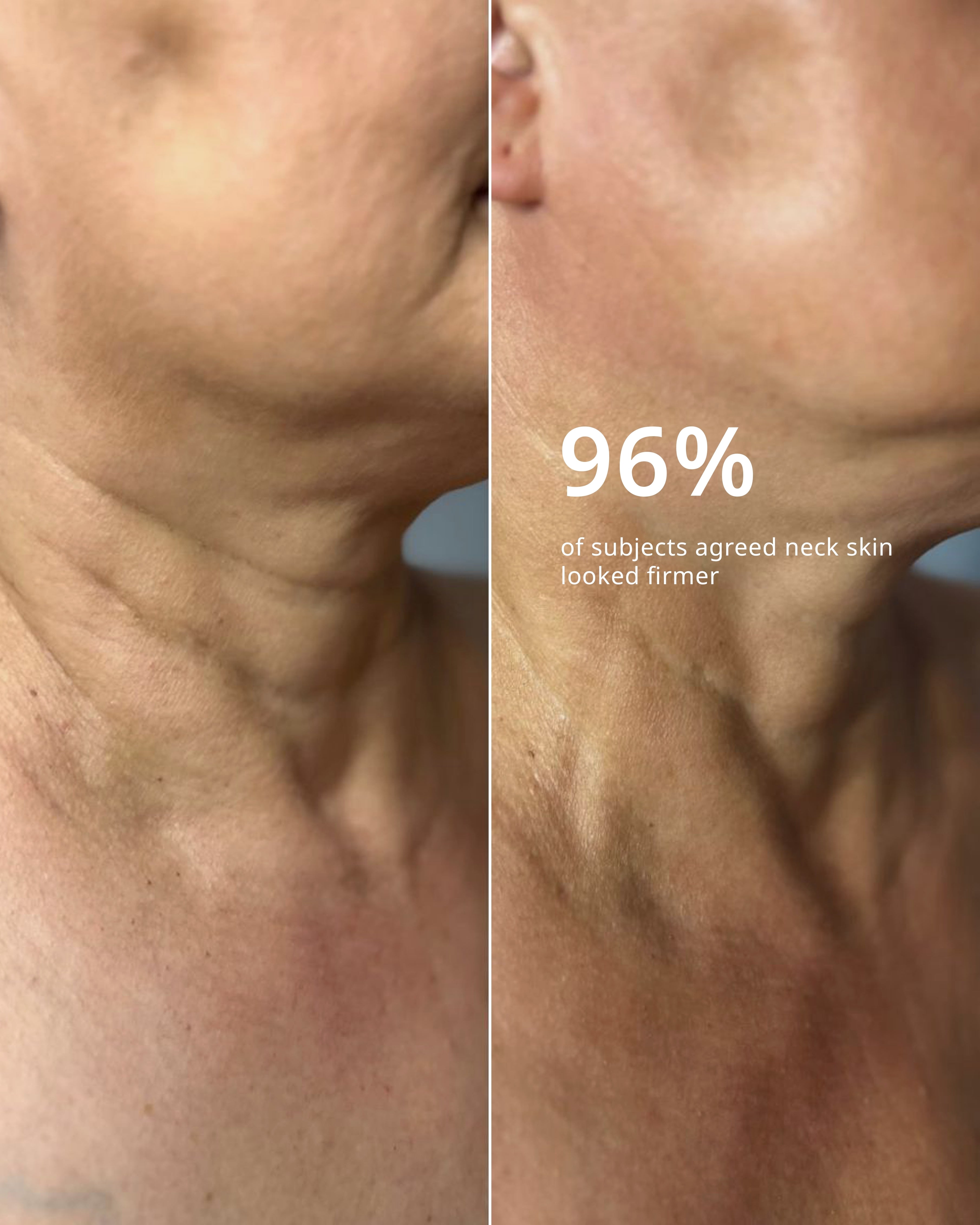 THE NECK TREATMENT