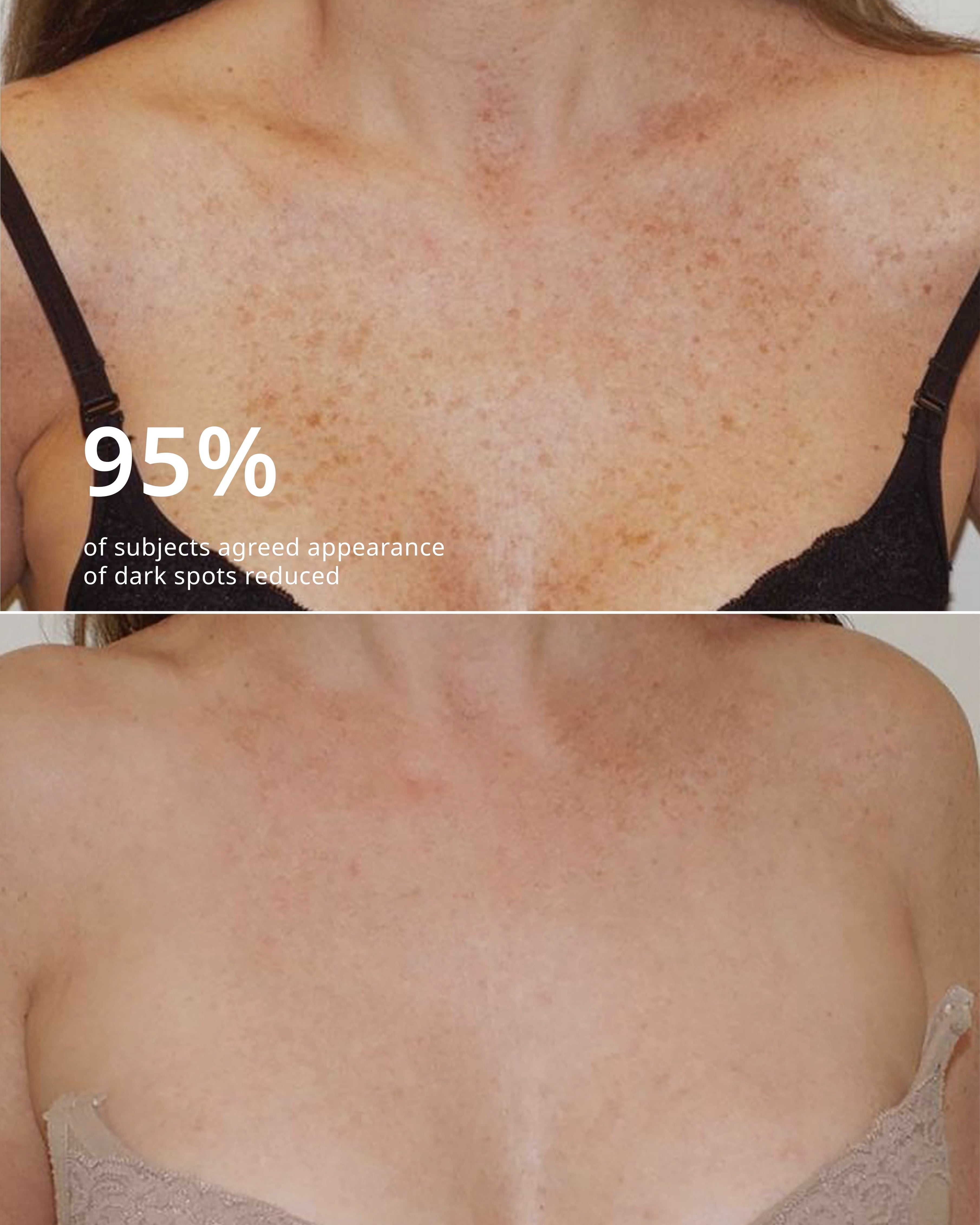 THE NECK TREATMENT