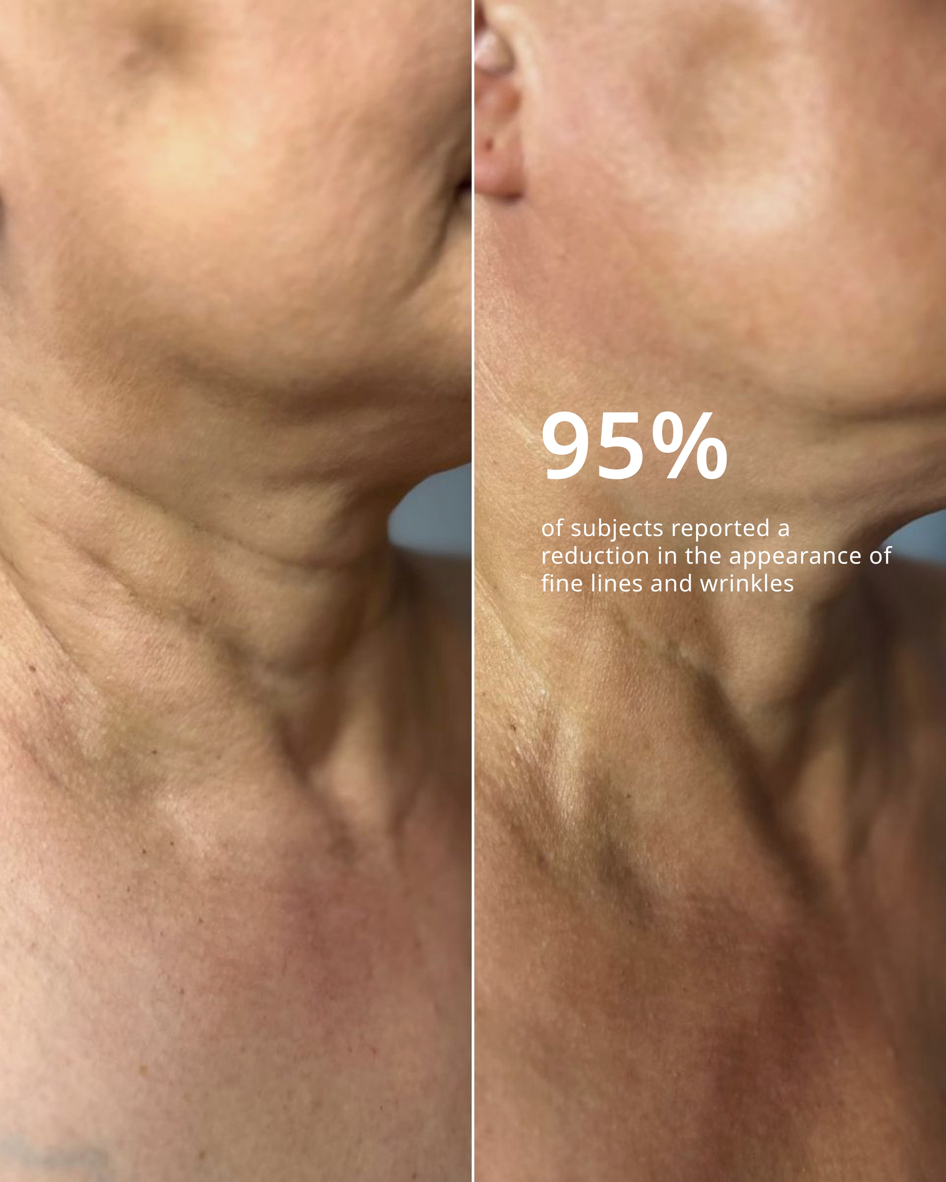 ADVANCED RETINOL NECK SERUM